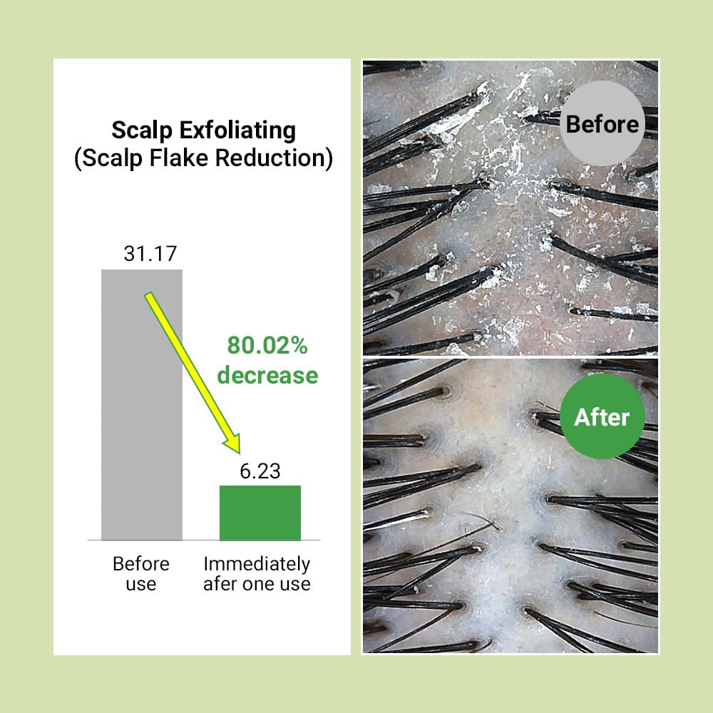 Real Mary Exfoliating Dry Scalp Shampoo, 13.52 Fl Oz - Organic Rosemary Hair for Itchy , Gentle Scalp Moisturizer, with Ginger & Peppermint Oil