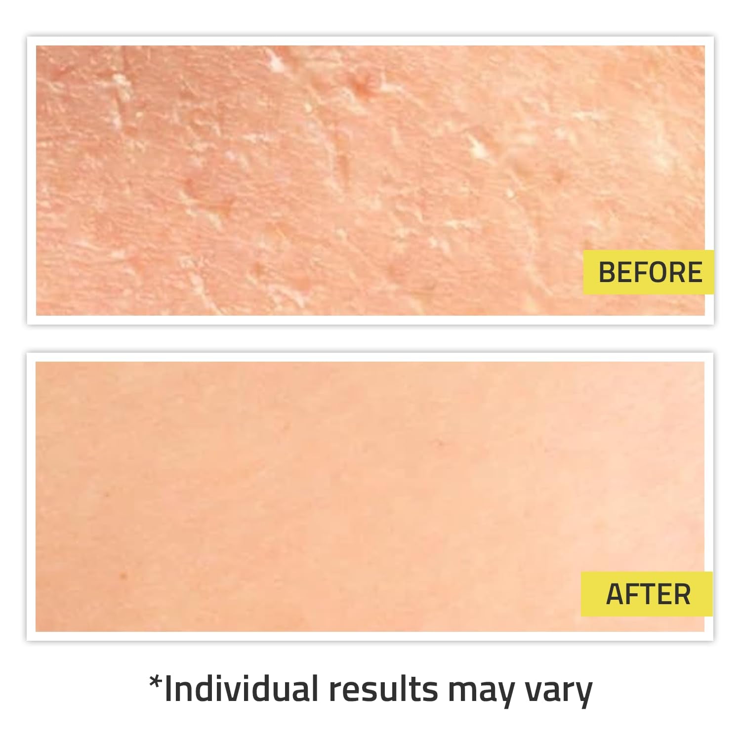 Snail Mucin Serum for Face, Hydrating Snail Face Serum with Hyaluronic Acid, Lightweight, Fast-Absorbing & Non-Sticky 3.4Oz