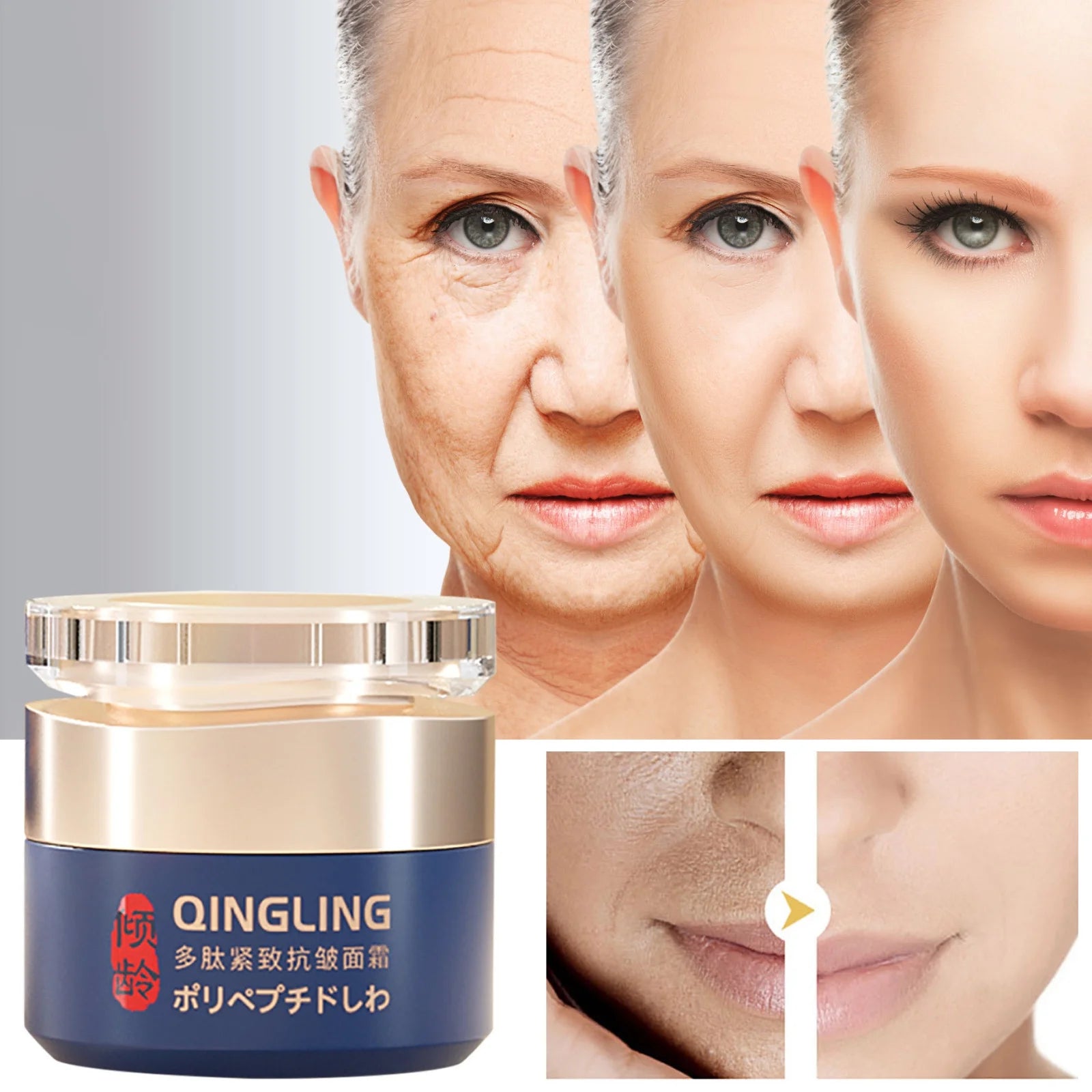 Qingling Wrinkle Removal Cream, Polypeptide Anti-Wrinkle Cream, Lift and Firm Moisturizer Face Cream (50G)