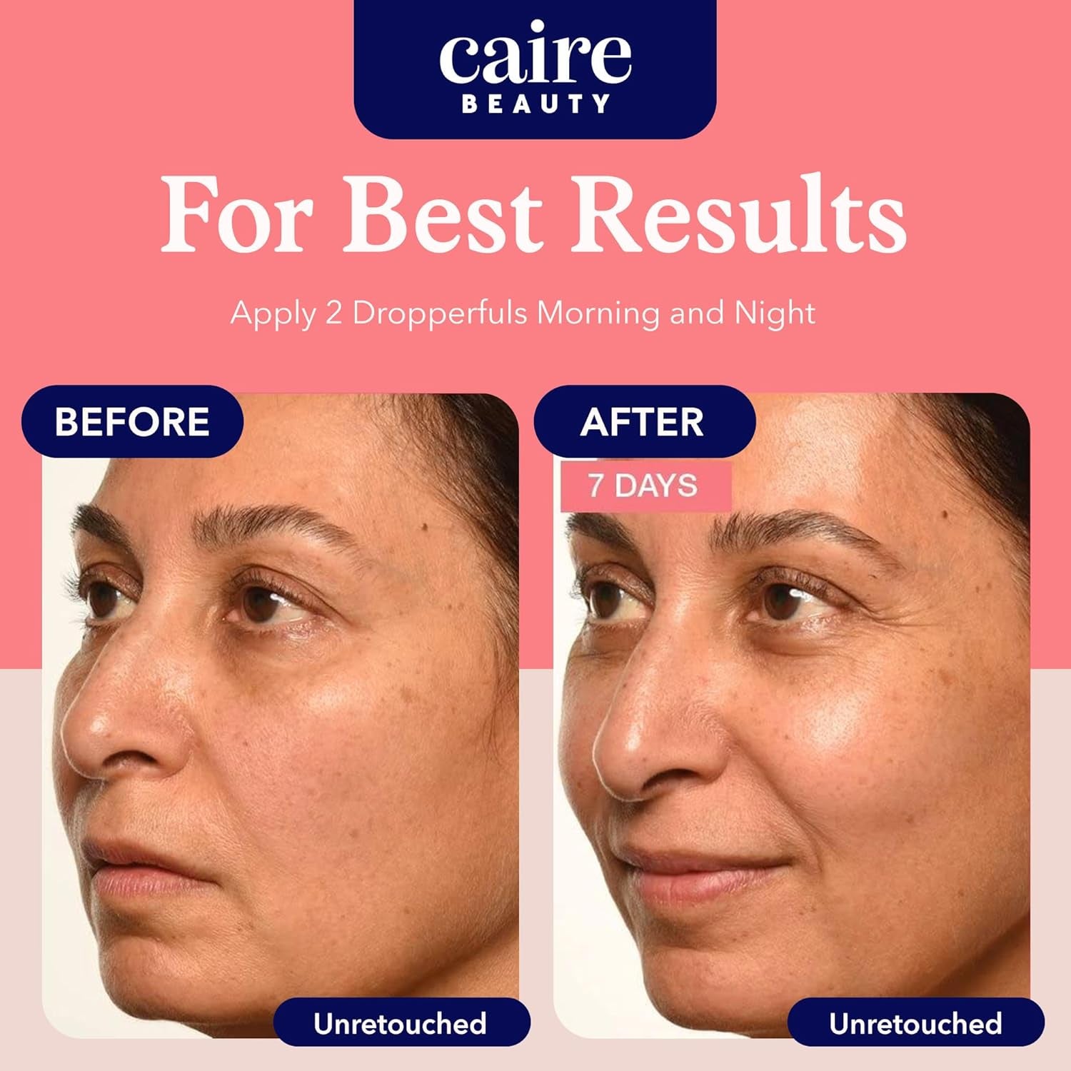 ‘Own Your Age’ Bioavailable Hyaluronic Acid Collagen Peptide Serum for Face, Eyes + Neck | 15Ml