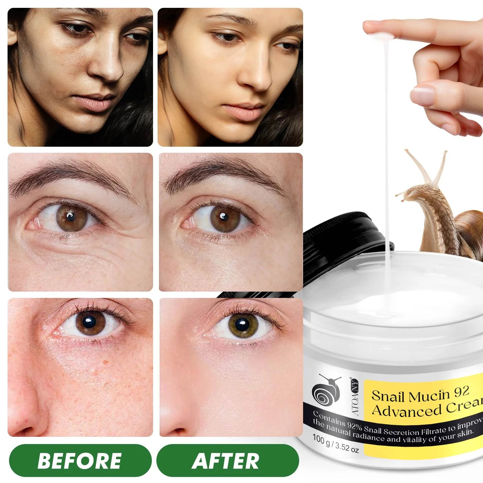 Snail-Mucin Moisturizer 92% Cream,Daily Face Moisturizer Hydrating for Women Dry Skin and Sensitive Skin,All Skin Types Skincare - 2Pack