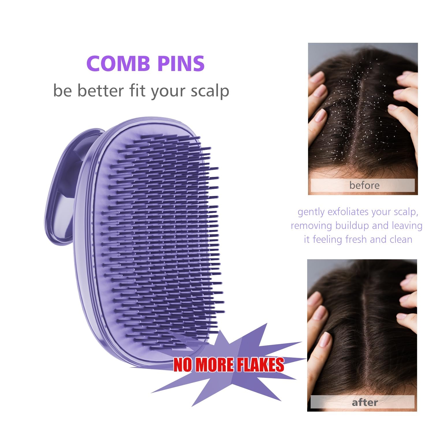 2-In-1 Scalp Massager Shampoo Brush,Scalp Scrubber, Exfoliator Brush for Removin