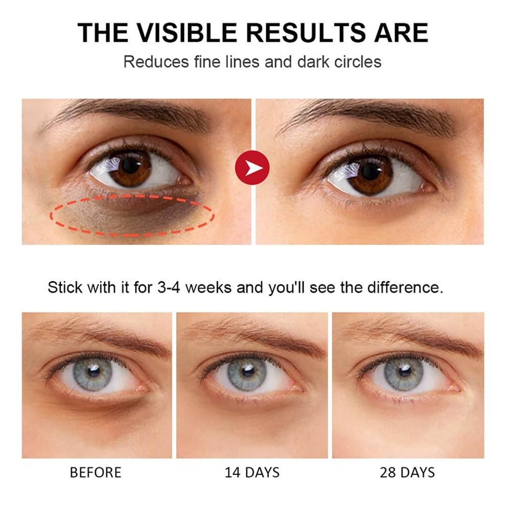 Retinol Eye Stick, Retinol Eye Cream with Collagen,Hyalu